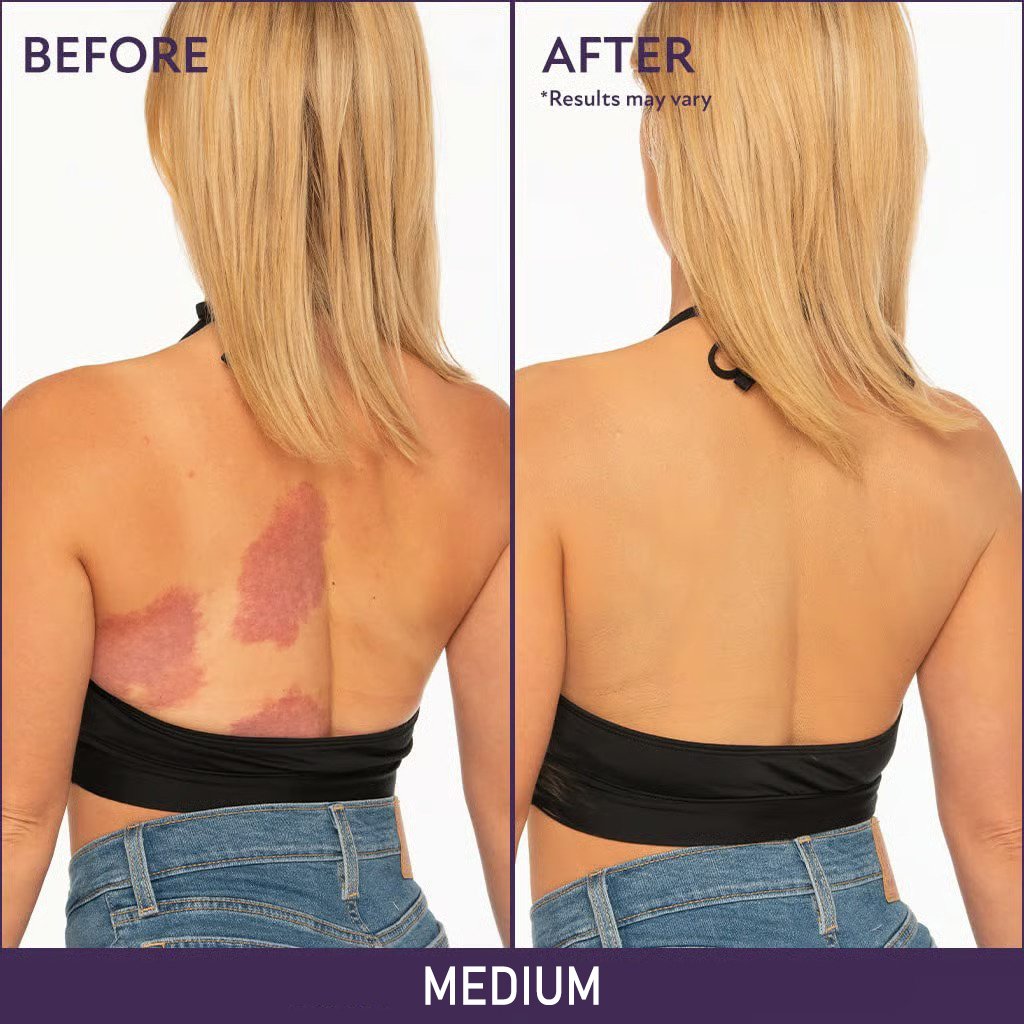 🎉Last Day Special Price🔥Soft Matte Cream Concealer