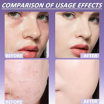 🎉Last Day Special Price🔥Soft Matte Cream Concealer