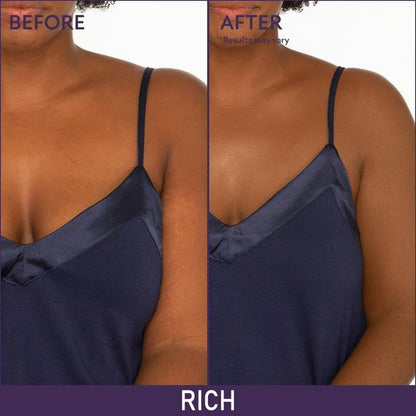 🎉Last Day Special Price🔥Soft Matte Cream Concealer