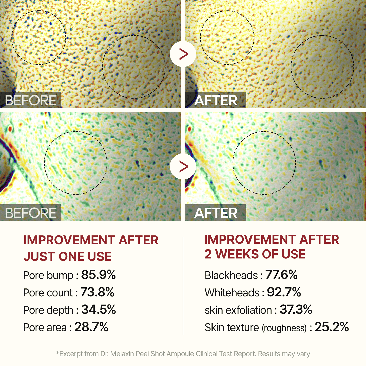 🔥Peel Shot Glow Rice Ampoule Duo - Serums for Brightening, Exfoliating, and Moisturizing