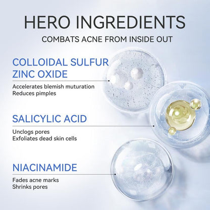 Salicylic Acid Acne Treatment Drying Lotion